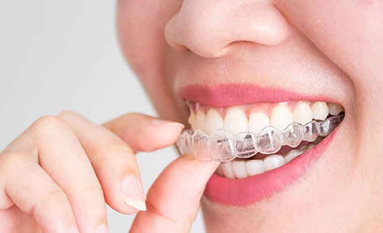 Clínica dental Chamberí Madrid Ortodoncia